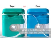 What is the Difference Between Dental Tape and Dental Floss