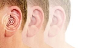 Hearing Loss - Types, Causes, and Treatment