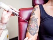 Can Tattoo Removal Cause Cancer