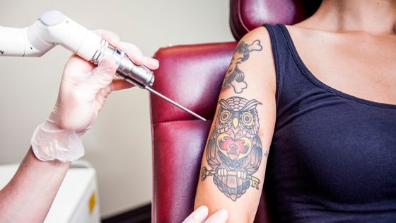 Can Tattoo Removal Cause Cancer